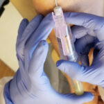 b12 injections manchester