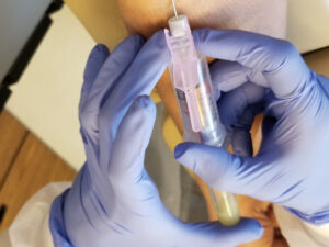 b12 injections manchester