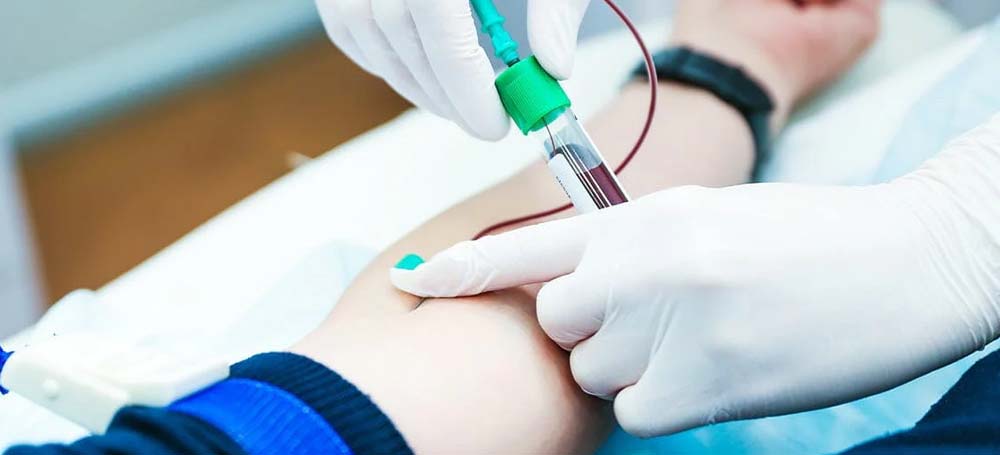 Book Your Blood Test Online